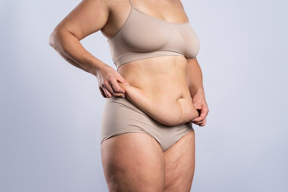 A woman pinching the fat on her stomach before a tummy tuck in Sherman Oaks